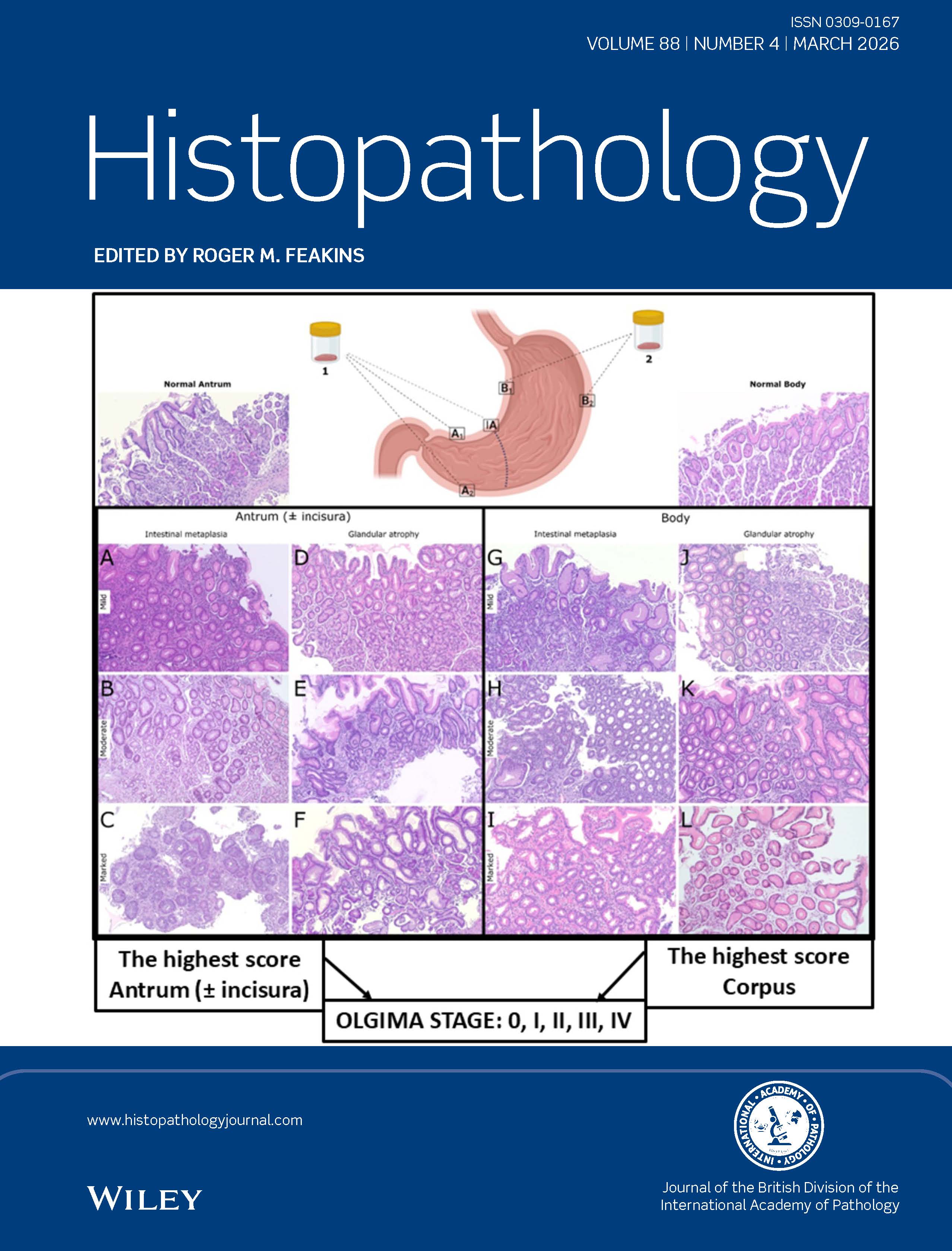Histopathology Journal Volume 88 Issue 4
